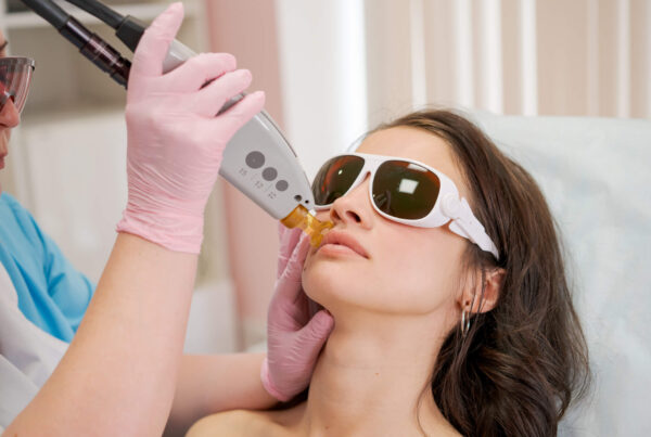 Laser Treatment